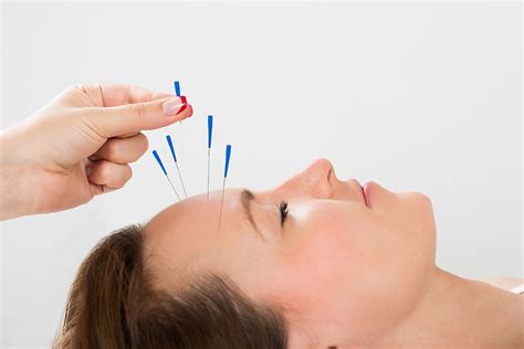 acupuncture and chinese medicine near me