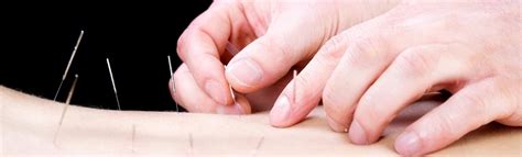 Acupuncture Bulging Disc Lower Back