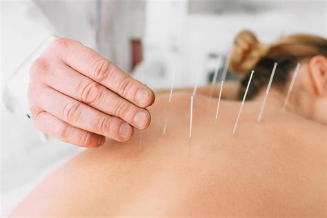 Acupuncture Charters Towers