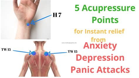 Acupuncture For Depression Points
