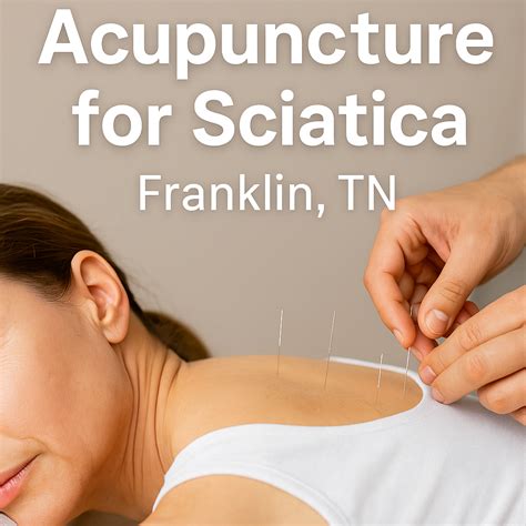Acupuncture Or Chiropractor For Sciatica