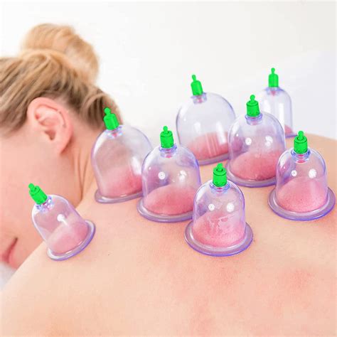 Acupuncture Suction Cups Therapy