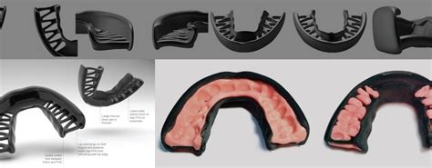 Ada Code For Athletic Mouth Guard