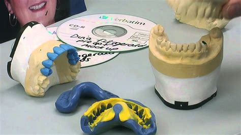 Ada Code For Lab Wax Up