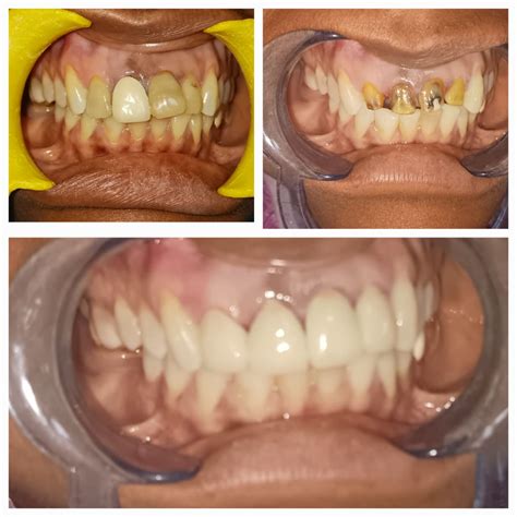 Additional Dental Issues