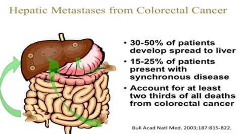 adenocarcinoma of colon metastatic to liver