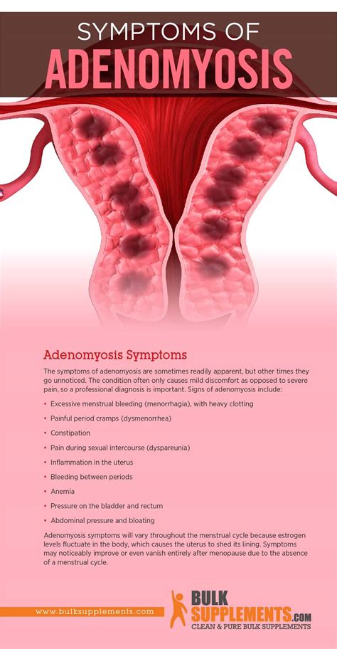 adenomyosis and back pain treatment