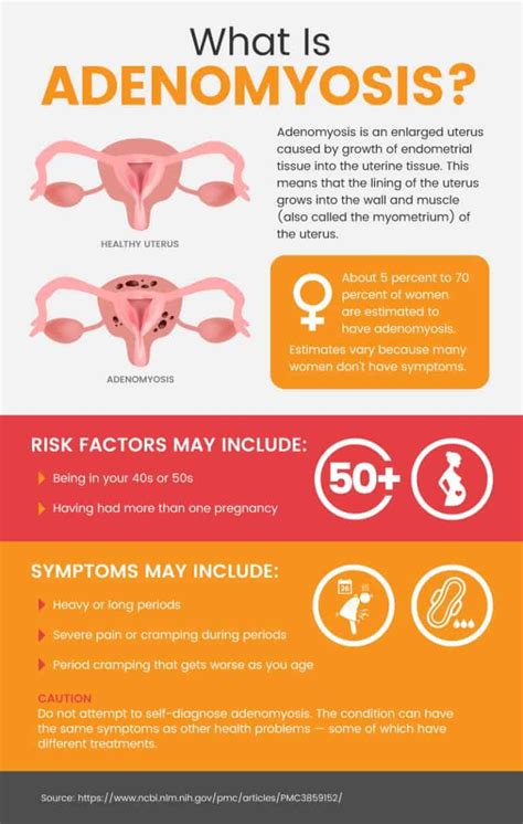 adenomyosis of the uterus patient info