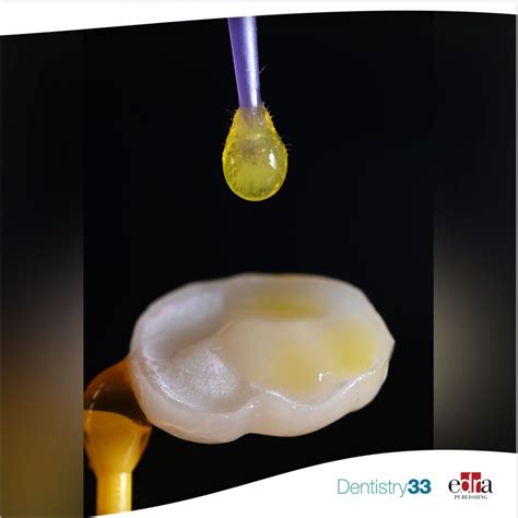 Adhesive Dentistry Research