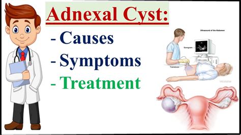 adnexal cyst symptoms