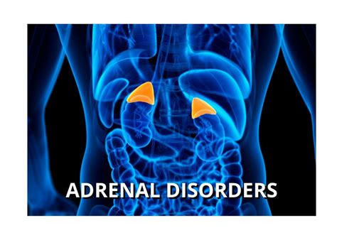 adrenal gland diseases and disorders