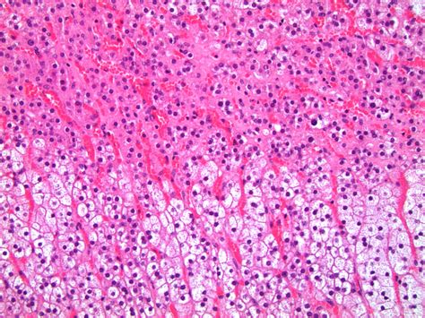 adrenal gland histology pathology outlines