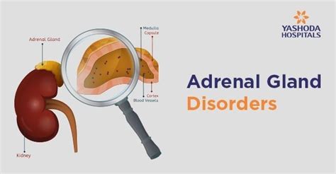 adrenal gland problems after prednisone