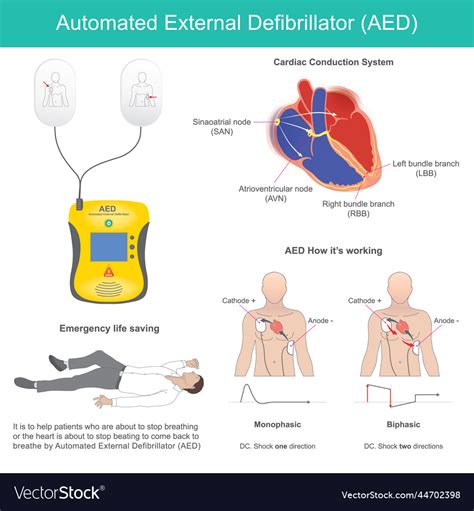 Aed Electrodes Quizlet