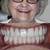 affordable dental implants kansas city