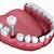 affordable dental implants south pasadena fl