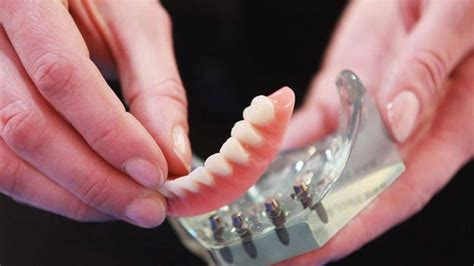 What's happening now at Affordable Dentures & Implants