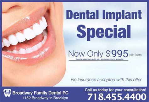 affordable dental implant offers