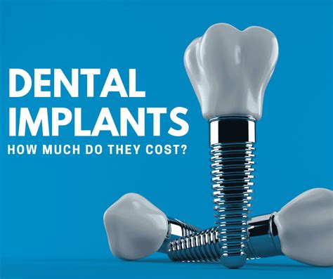 affordable dental implants cost near you