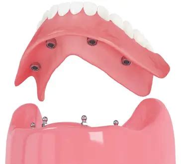 affordable dentures jackson tn