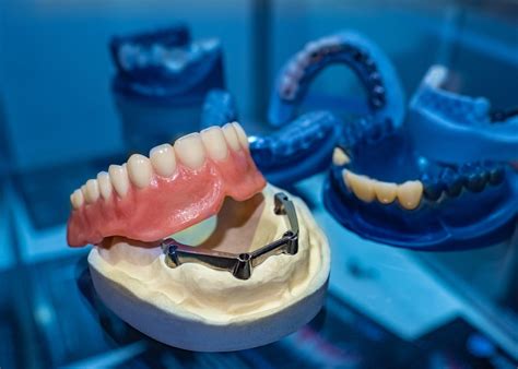 affordable dentures tampa possibilities