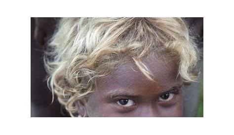 Africans Born With Blonde Hair Woman Impregnated Black Man's Sperm By Mistake