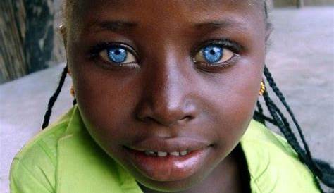 Africans With Blue Eyes And Blonde Hair 58 Best Photos Solomon Islands Blond TRIP
