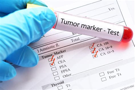 aft tumor marker blood test