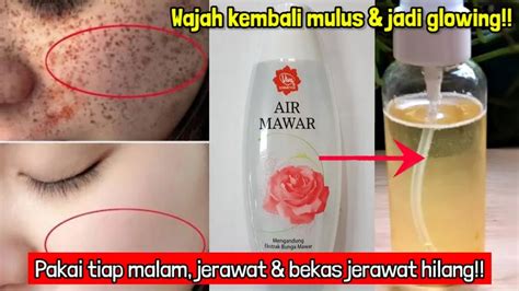 Air Mawar Viva Meredakan Jerawat