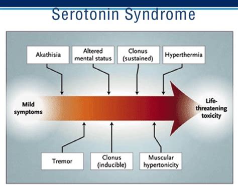 akathisia in serotonin syndrome
