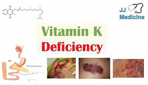 Defisiensi Vitamin K : Tanda Bahaya hingga Pengobatan | Dokter Muslim