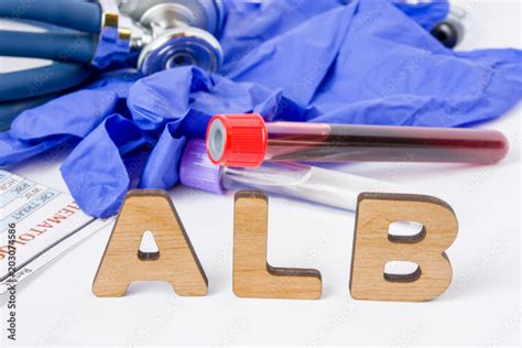 What Does an Alb Blood Test Reveal About Your Liver Health?