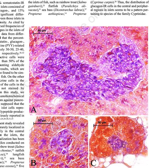 Aldehyde Fuchsin Stain