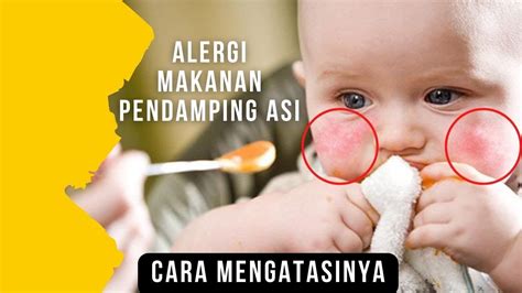 alergi makanan bayi