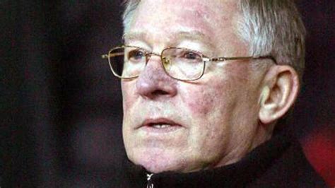 alex ferguson nose