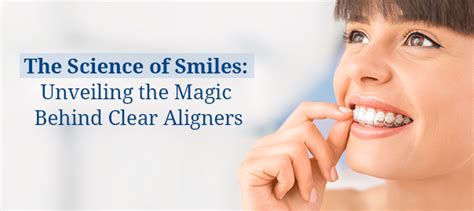 Aligners Without Braces