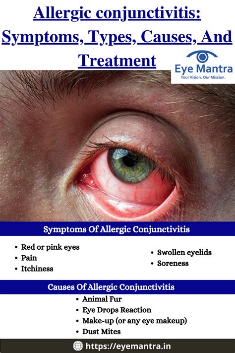 Understanding Allergic Conjunctivitis Symptoms: What You Need to Know