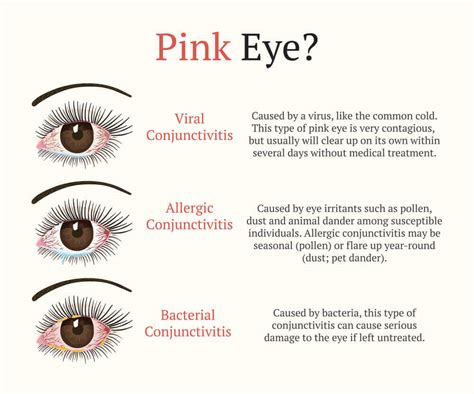 Understanding Allergic Pink Eye: Causes, Symptoms, and Effective Treatments