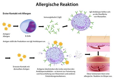 allergische reaktion
