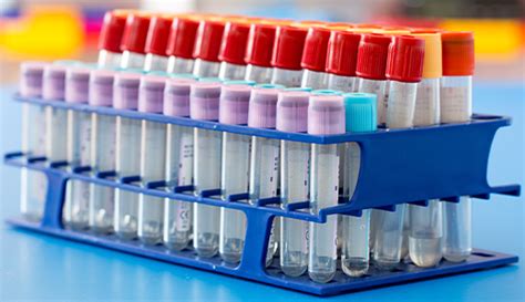 Allergy Testing San Jose