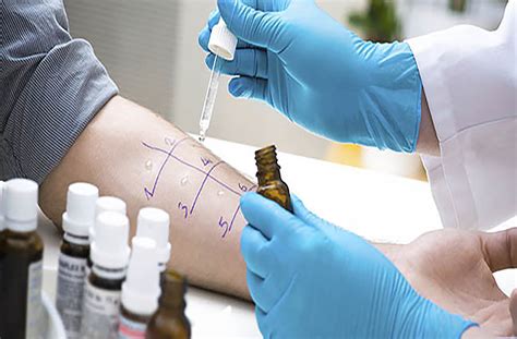 Allergy Testing Yonkers