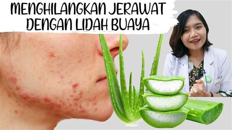 Aloe Vera Meredakan Jerawat