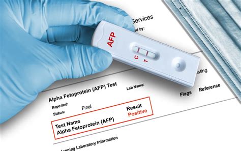 Unlocking Pregnancy Insights: What Does a Positive Alpha FP Test Really Mean?