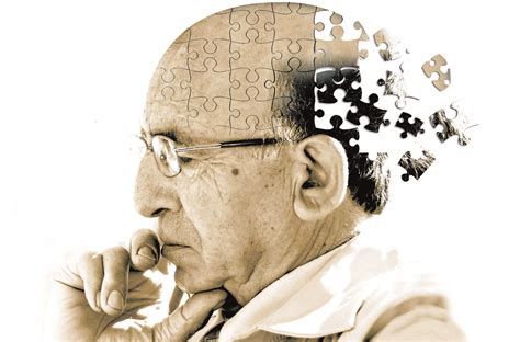 Alzheimer Que Es: Entendiendo la Enfermedad de Alzheimer