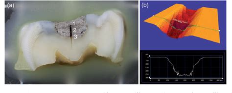 Amalgam Diffusion