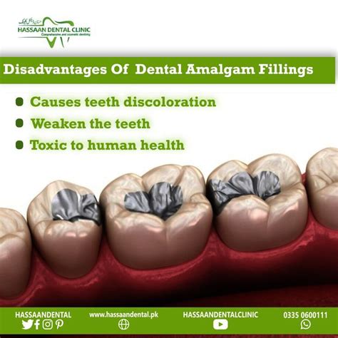 Amalgam Fillings Burning