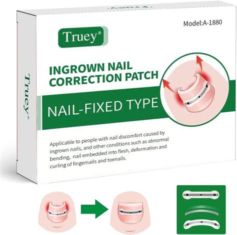Amazon Ingrown Toenail Corrector