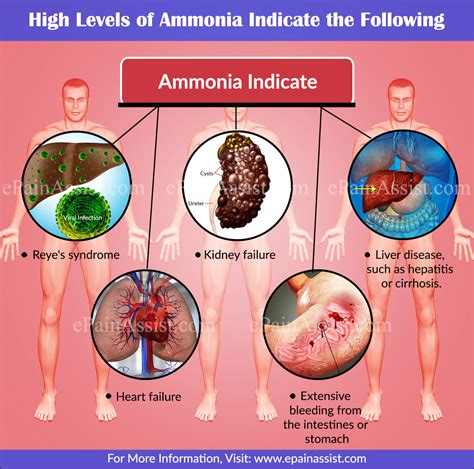 ammonia sickness