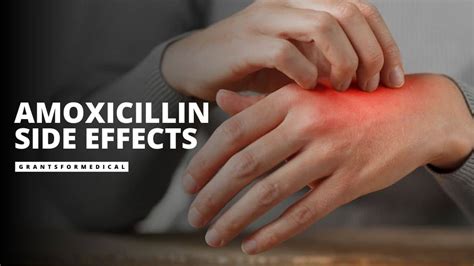 Understanding Amoxicillin 500 mg Side Effects: What You Need to Know