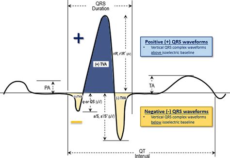 amplitude of qrs complex in ecg